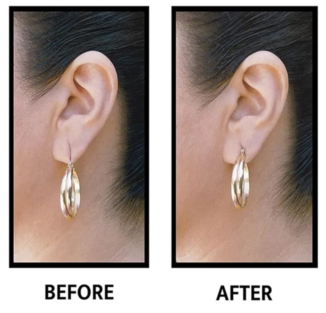 Invisible Ear Lobe Support Tape - Earring Backs for Droopy Ears - Ear Care Products for Torn or Stretched Ear Lobes (100 patches)